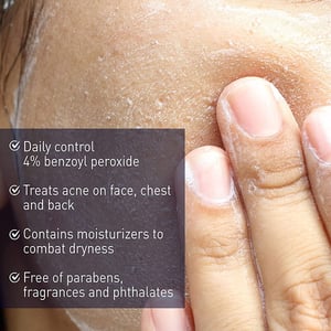 PanOxyl Acne Creamy Wash 4% Benzoyl Peroxide Daily Control 170g•