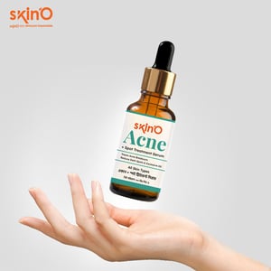 Skin'O Acne + Spot Treatment Serum 30ml