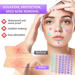 40pcs Acne Pimple Master Patch - Pink