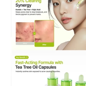 Purito Azelaic Acid 10% + Kojic Acid + Tea Tree Facial Serum 30ml •