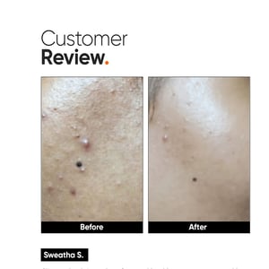 The Minimalist Vitamin C 10% Face Serum 30ml•