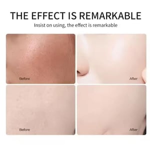 Yan Namei Ji Apple Peeling Gel 320ml  •