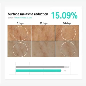 CARE:NEL Anti Melasma Cica Intensive Serum 30ml •
