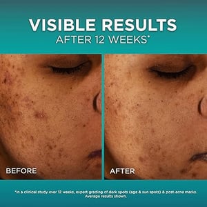 L'Oreal Paris Bright Reveal Niacinamide Anti Dark Spot Serum 30ml  •