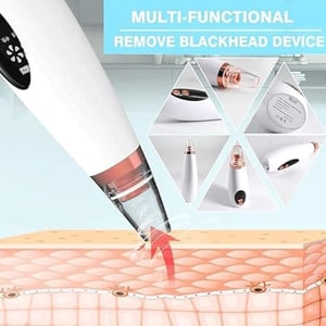 6 In 1 Multi-Function Blackhead Remover Tool