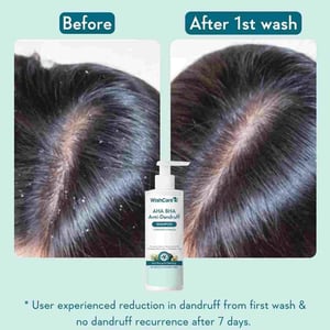 WishCare AHA BHA Anti Dandurff Shampoo 250ml •