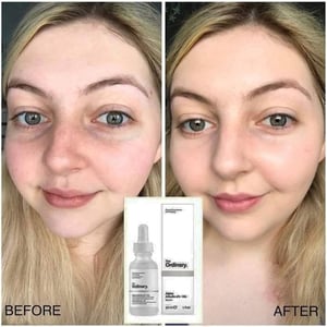 The Ordinary Alpha Arbutin 2% HA 30ml •