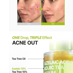 Purito Azelaic Acid 10% + Kojic Acid + Tea Tree Facial Serum 30ml •