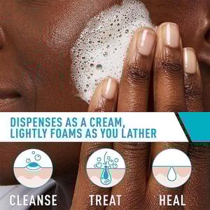 CeraVe Acne Foaming Cream Cleanser 4% Benzoyl Peroxide 150ml .