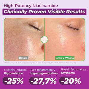 JUMISO Niacinamide 20 Serum Dark Spot Correcting Serum 40ml •