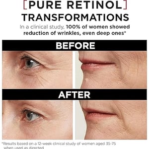 L'oreal Paris Revitalift Laser 0.2% Pure Retinol Night Serum 30ml  •