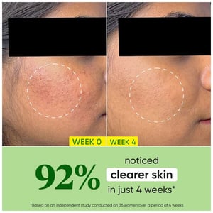 Dot & Key Skincare Cica Calming Oil Free Moisturizer 15ml •