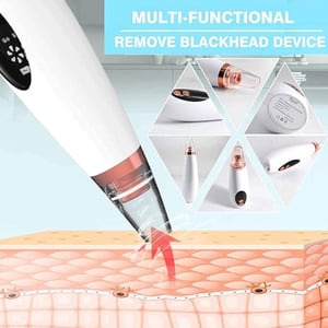 6 In 1 Multi-Function Blackhead Remover Tool