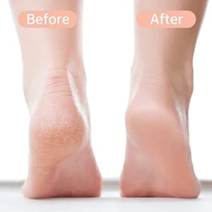 Liangyu Double Sided Foot Scrubber - White