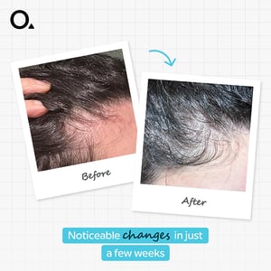 The Ordinary Hair Care Multi-Peptide Serum For Hair Density 60ml •