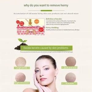 Yan Namei Ji Pomegranate Peeling Gel 320ml  •