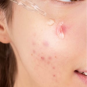 CARE:NEL Dr.Skin Niacinamide Zinc Serum 30ml •