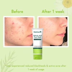 WishCare Salicylic Face Wash 100ml  •