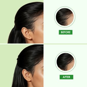 Lily Advanced Hair Growth Serum Oil 200ml - Bhringraj