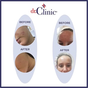 dr.Clinic Skin Regenerating Spot Cream 50ml