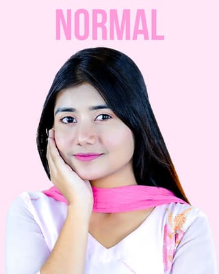 Normal