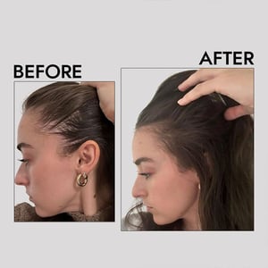 Care:Nel High Intensity Anti Hair Loss Hair Scalp Tonic 150ml •