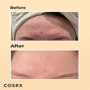 COSRX Advanced Snail 96 Mucin Power Essence 100ml ▪