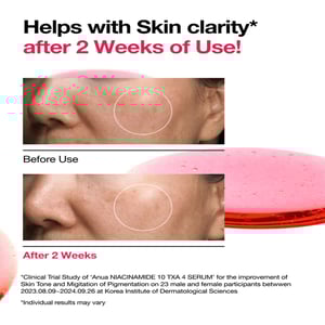 Anua Niacinamide 10% + TXA 4% Dark Spot Correcting Serum 30ml•