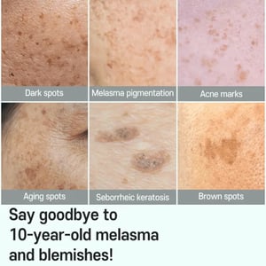 CARE:NEL Anti Melasma Cica Intensive Serum 30ml •
