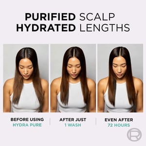 L'Oreal Elvive Hydra Pure Rehydrating Conditioner For Oily Scalp & Roots Dehydrated Length 300ml ▪