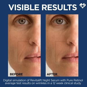 L'Oreal Paris Revitalift Derm Intensives Night Serum with 0.3% Pure Retinol 30ml•