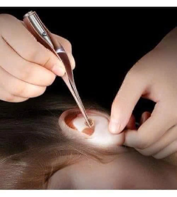 BỘ SOI TAI VÀ DỤNG CỤ GẮP CÓ ĐÈN