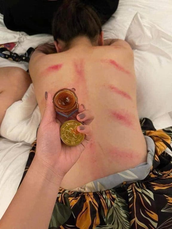 CAO HỔ Tiger Balm Thái Lan