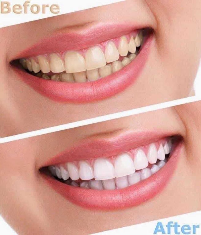 Kem đánh răng Crest 3D White Pro Advenced Whitening Mỹ tuýp 147g