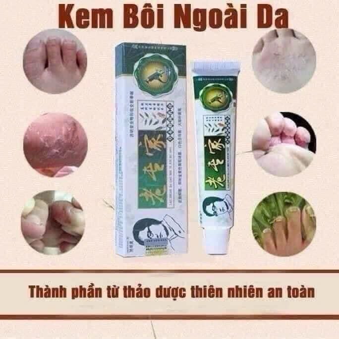 KEM BÔI NGỨA NỘI ĐỊA TRUNG chuẩn loại 1