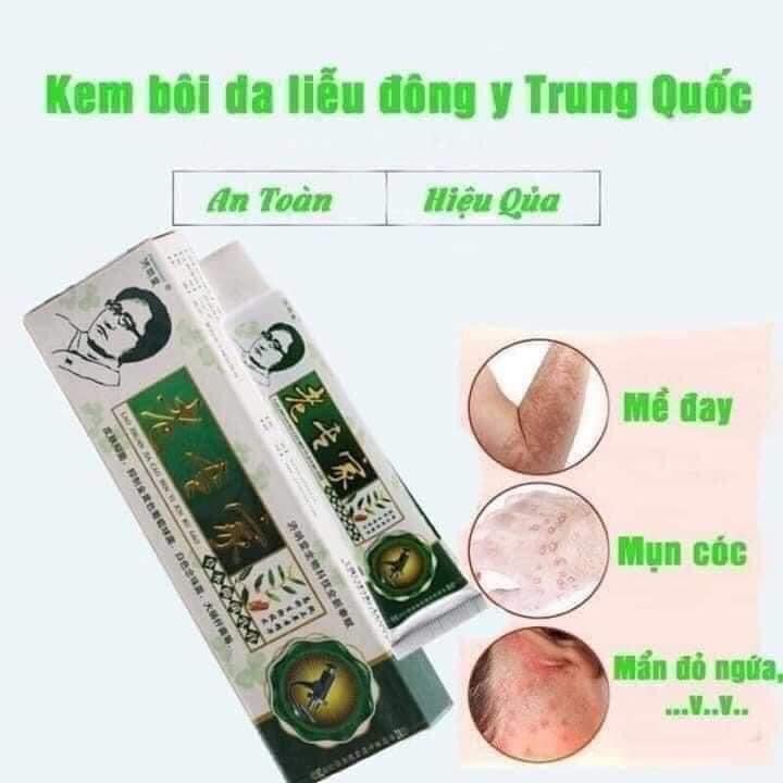 KEM BÔI NGỨA NỘI ĐỊA TRUNG