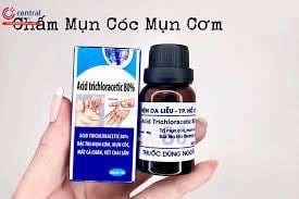Chấm mụn cóc xanh acid tricho