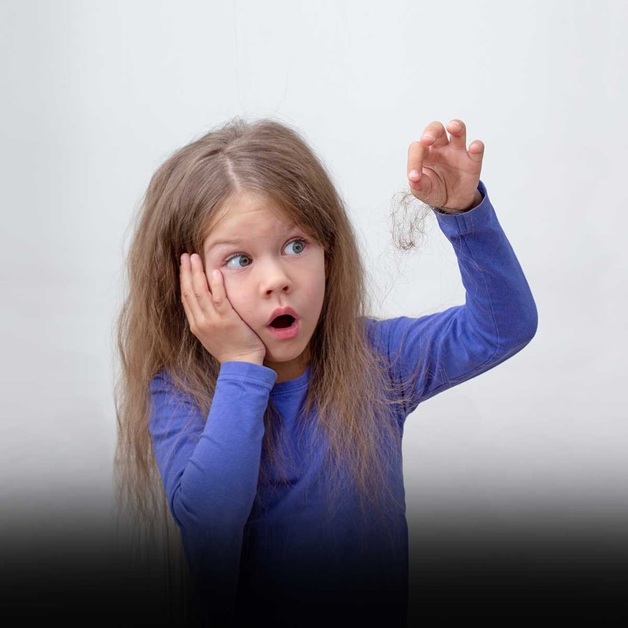 Children with Alopecia Day