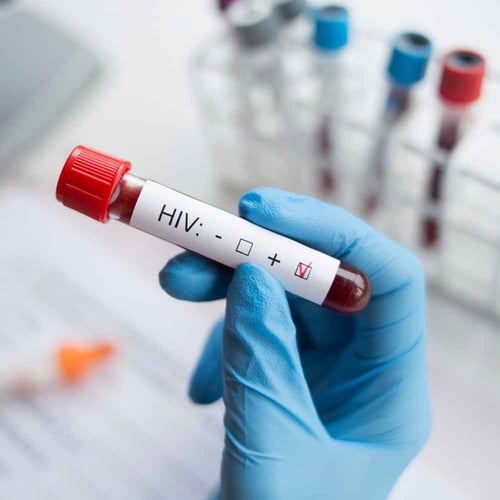 National HIV Testing Day