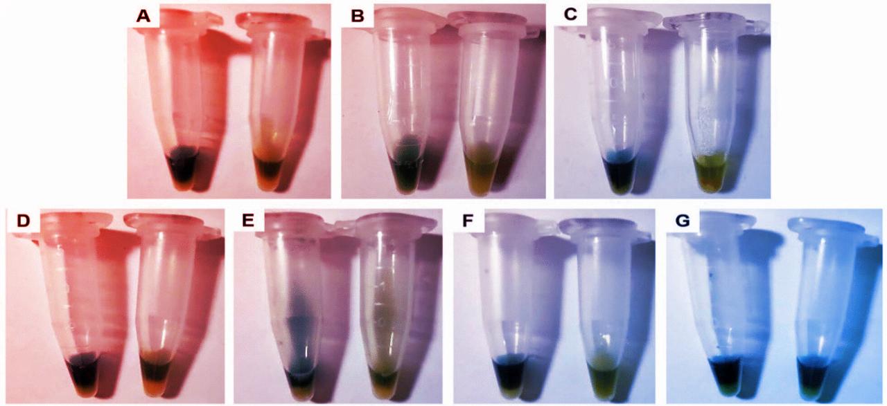A multirezisztens baktériumok megjelentek Chile szennyvizében