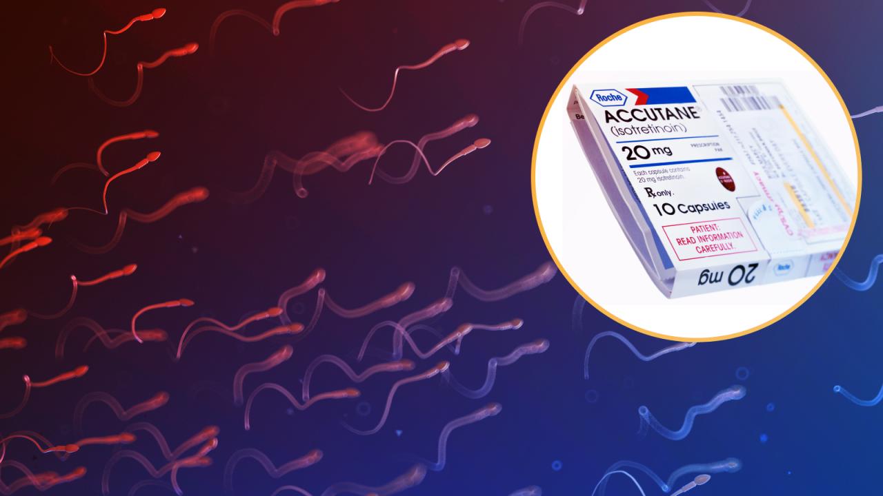 Akne elleni gyógyszer, ami segíthet visszanyerni a férfi termékenységet