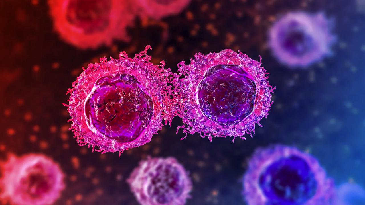 Az agy után a hasnyálmirigyben is megjelent a demencia