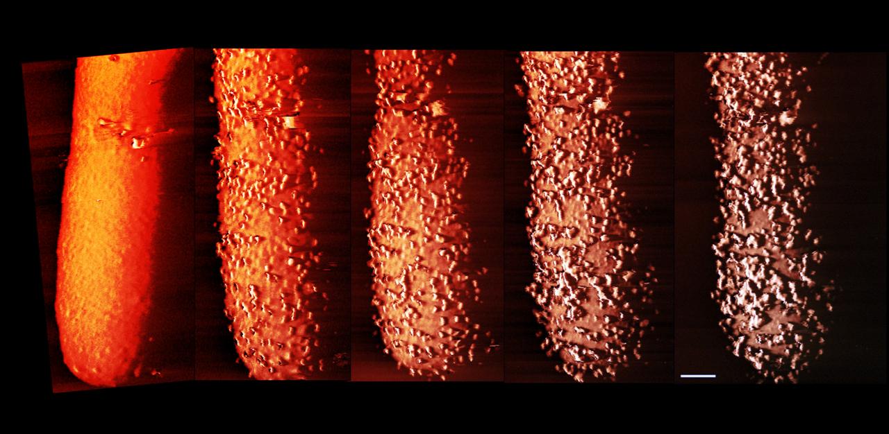 Az antibiotikum, amely szétrobbantja a baktériumokat