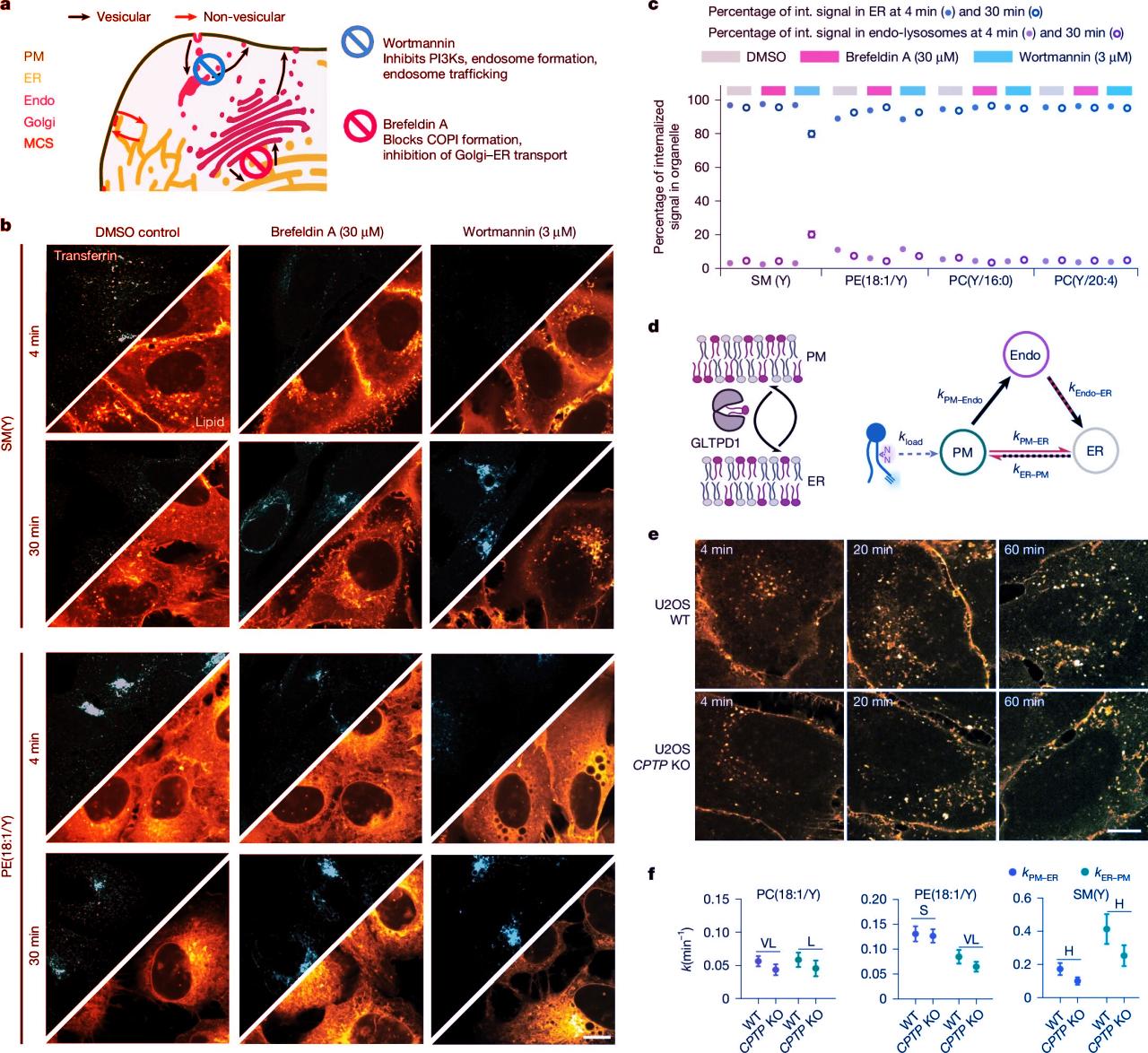 Az idegeidet is gyorsabban cserélik zsírt a sejtjeid, mint hinnéd