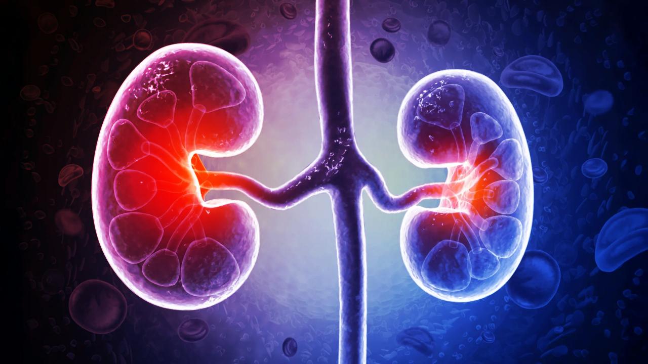 Bélbaktériumok pusztítják a veséket, kevesen tudnak erről