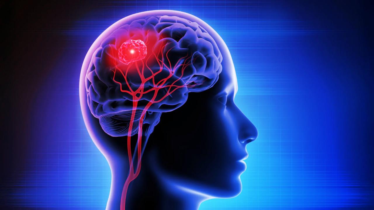 Itt a színes röntgen, új remény a rák kiszűrésében