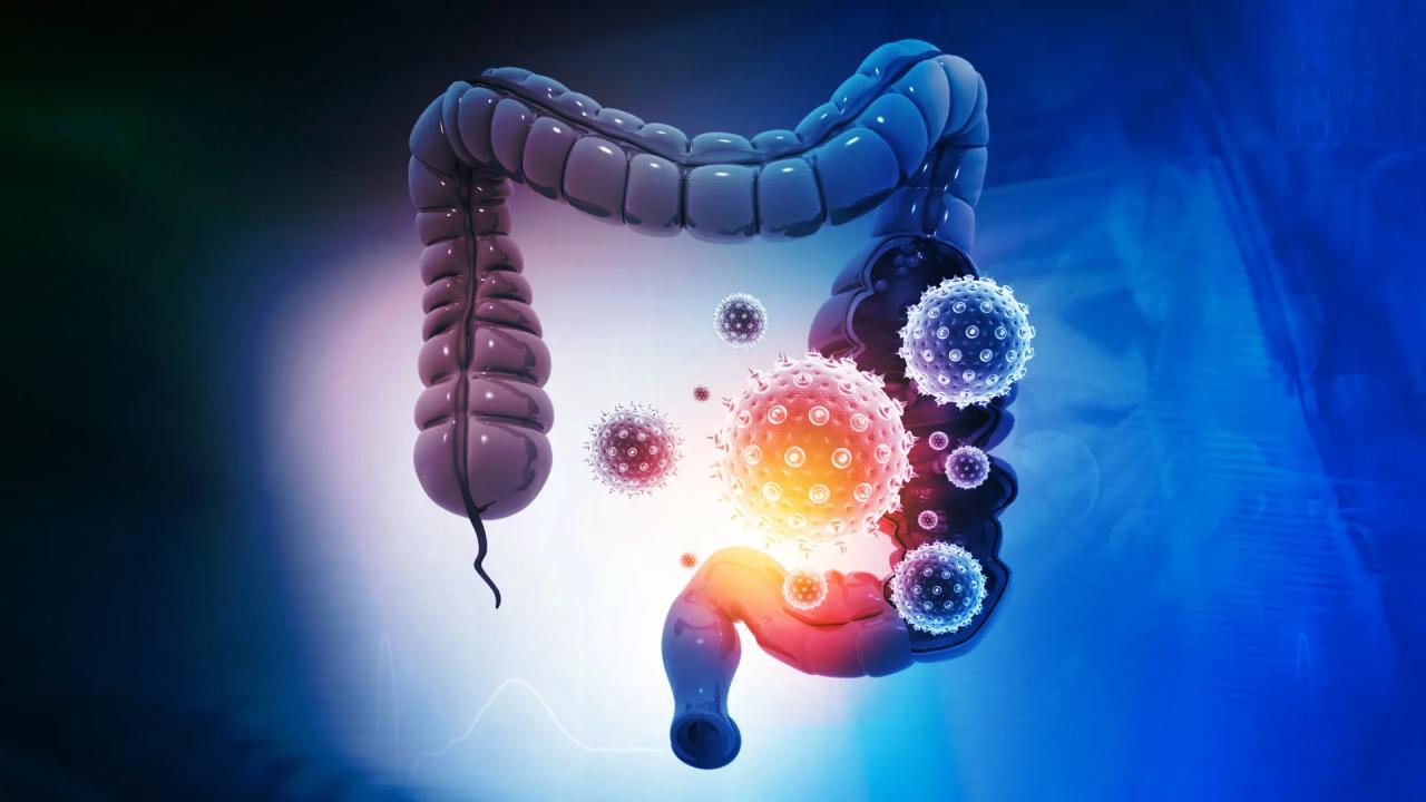 Jön az olcsó székletvizsgálat, vége a vastagbéltükrözésnek?