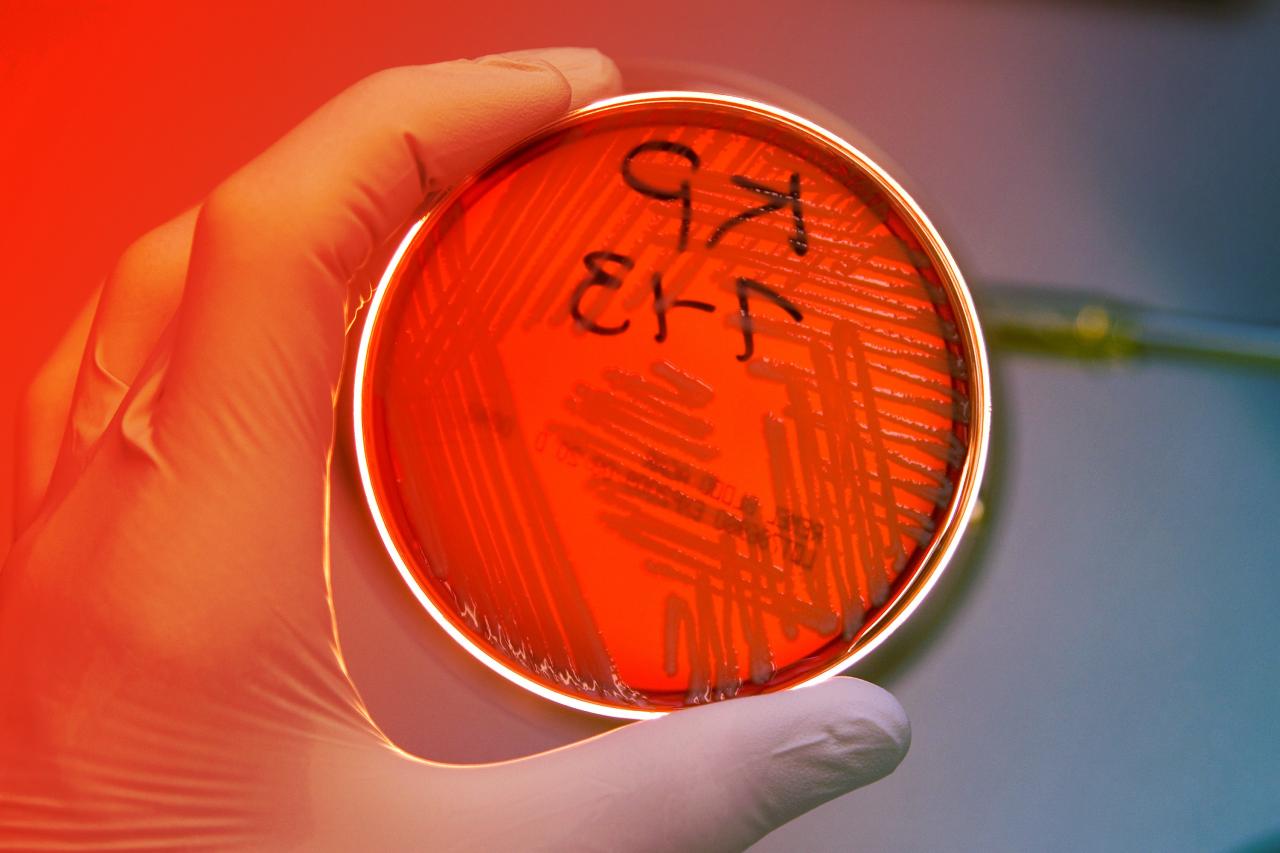 Újra támadnak a veszélyes éjszakai baktériumok a kórházakban