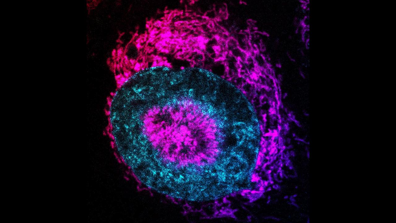 Áttétek rejtett energiája, új remény a rák gyógyításában