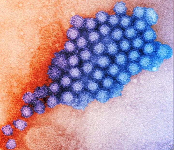 Norovírusok, ezekért olyan veszélyesek a gyomrunkban